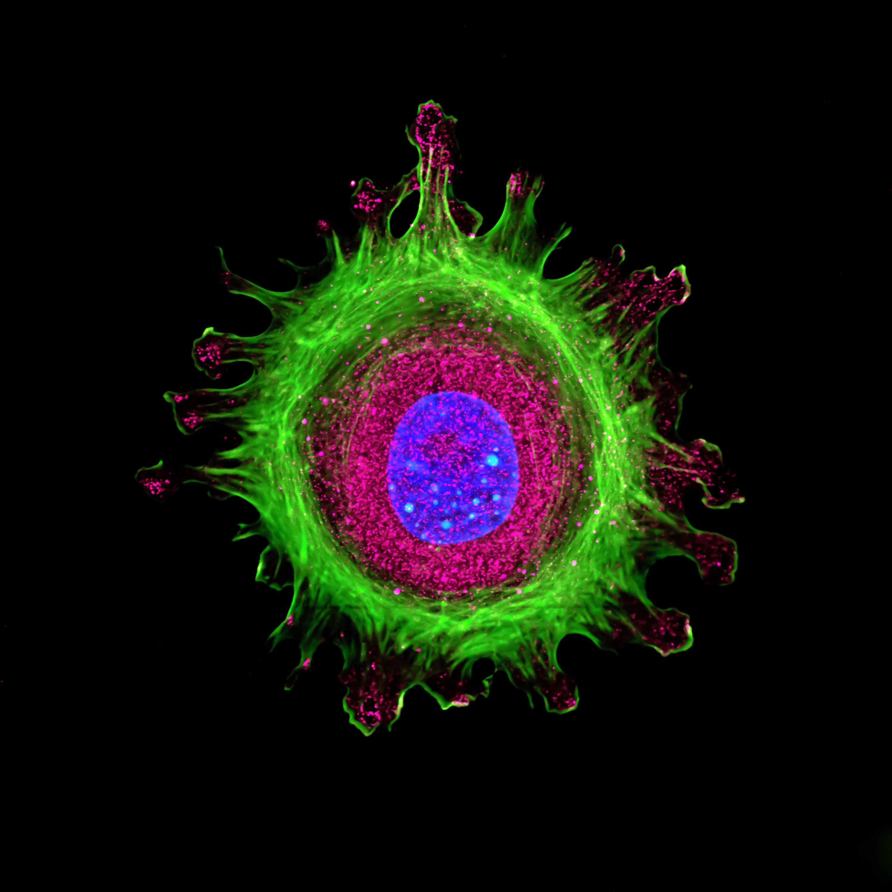 Immunofluorescence of single human cell stained, grown in tissue culture, stained with multiple antibodies and visualized via confocal microscopy